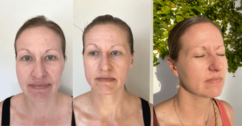 Inner Mouth Buccal Massage Before and After